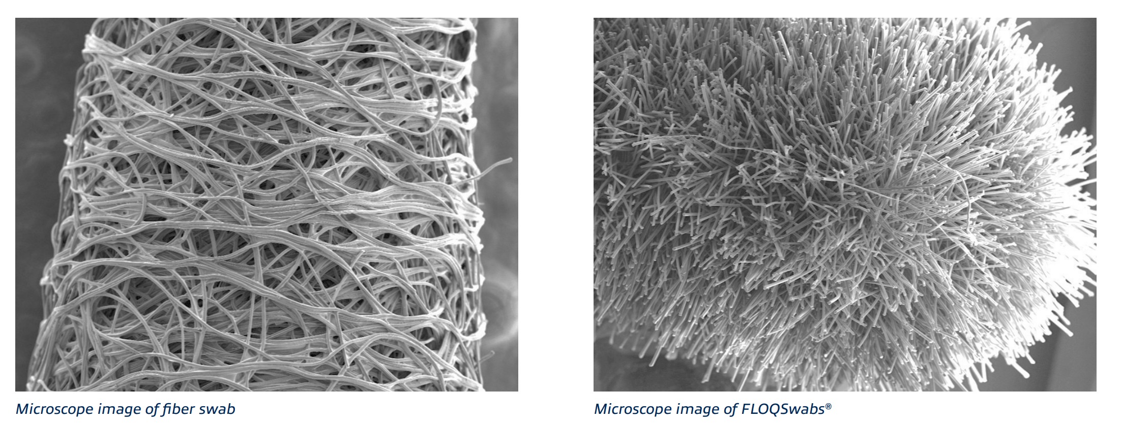 Microscopic image comparison of traditional swab and FLOQ swab